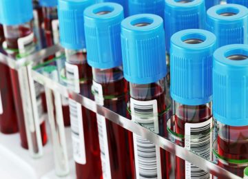 Haematology