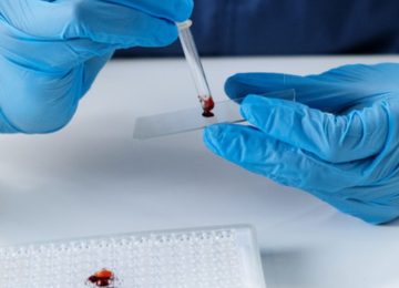 Serology